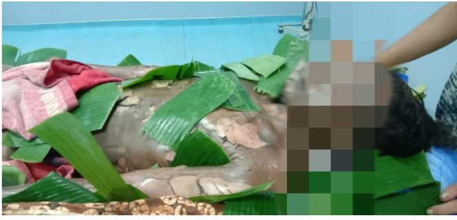 
					Pria Aceh Utara ini Nekat Bakar Diri, Begini Kondisinya…